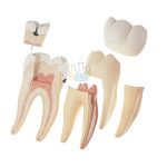Right lower first molar model